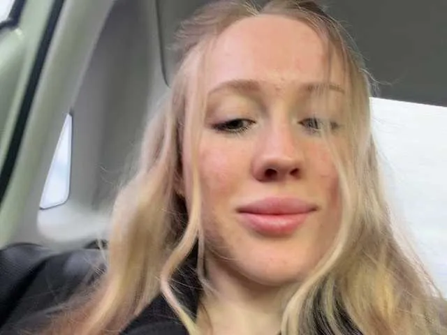 Likachkaa